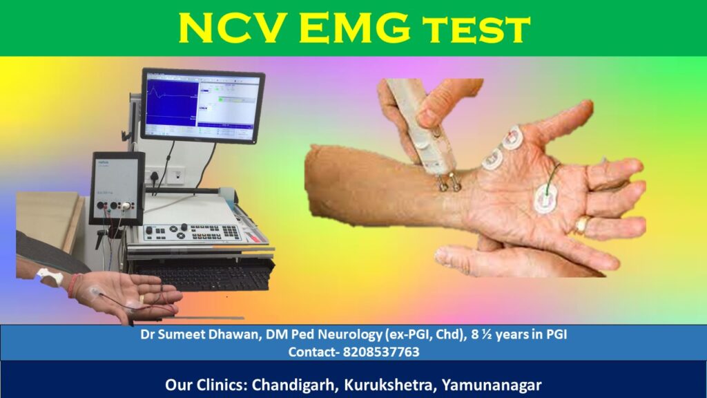 What Does Ncv Test For