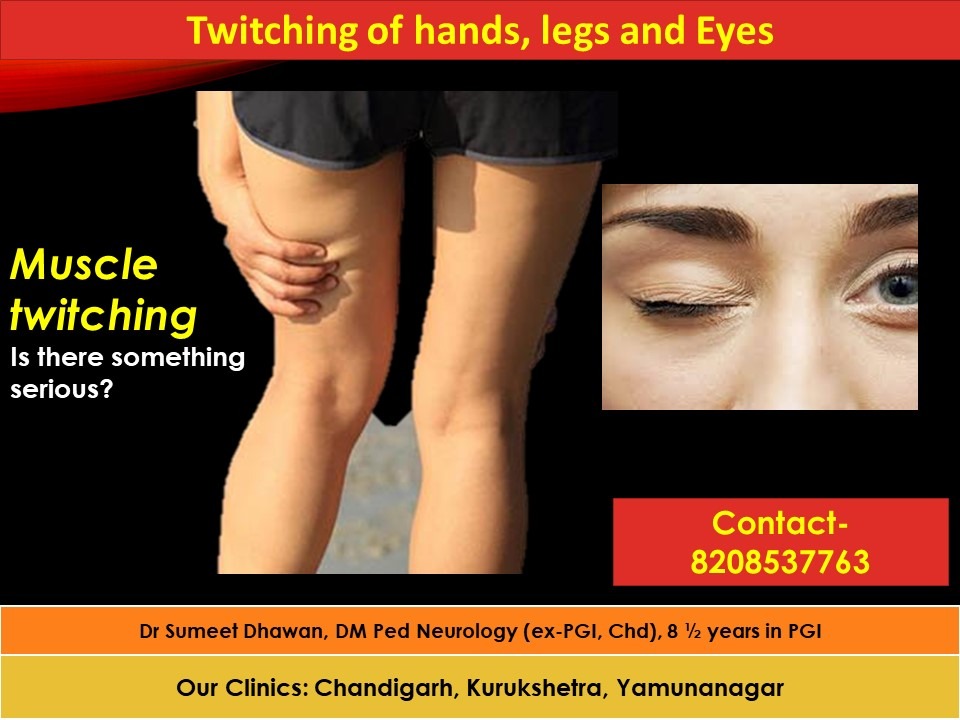 Muscle twitching treatment and causes - Dr Sumeet Dhawan, Neurologist-  Adult and Child), DM Pediatric Neurologist