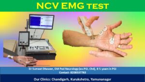 Nerve NCV EMG test in Chandigarh Mohali Panchkula - Dr Sumeet Dhawan