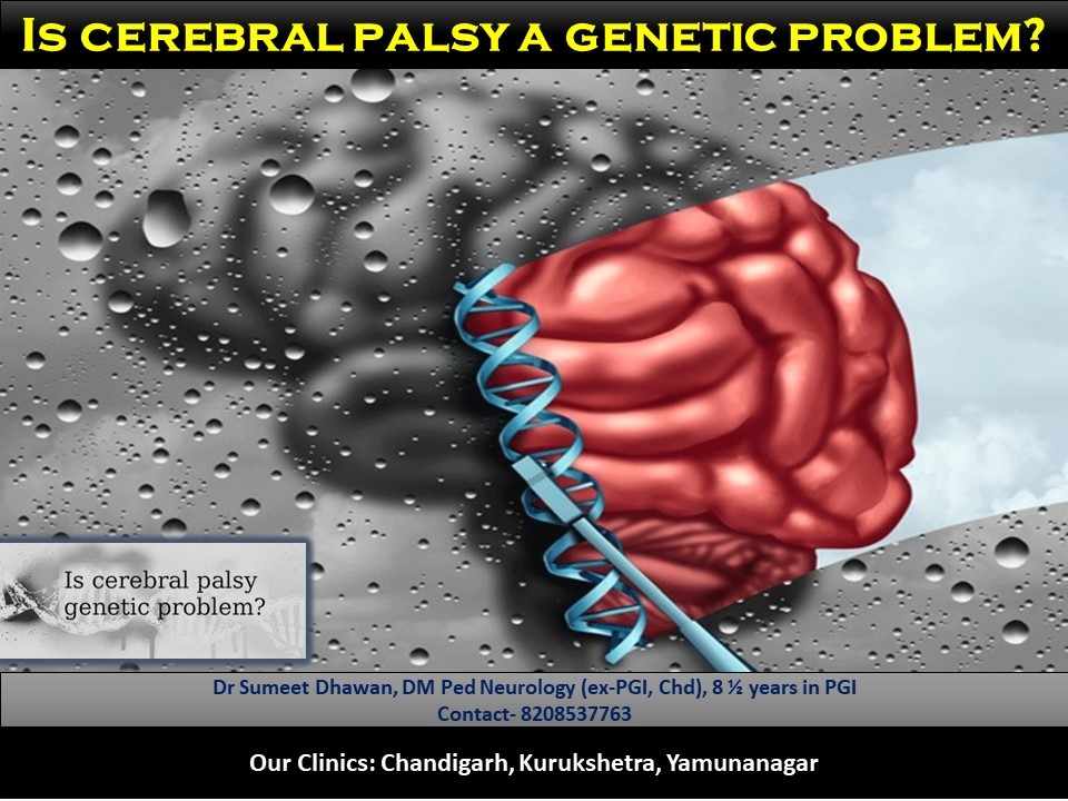cerebral palsy treatment and genetics