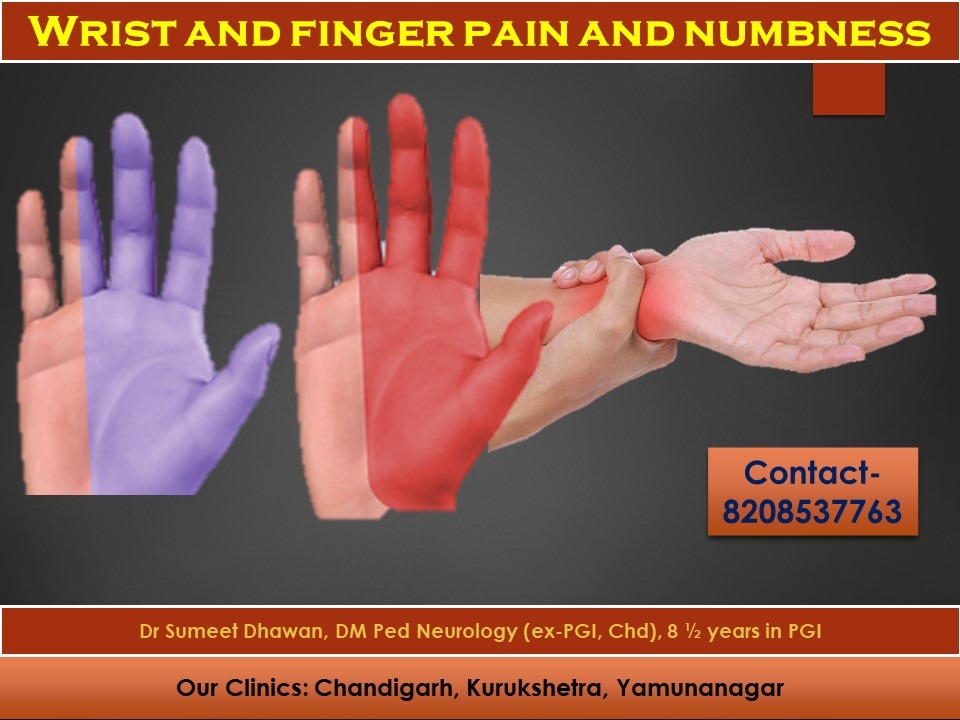 Numbness of hands Act before it too late!!! Dr Sumeet Dhawan