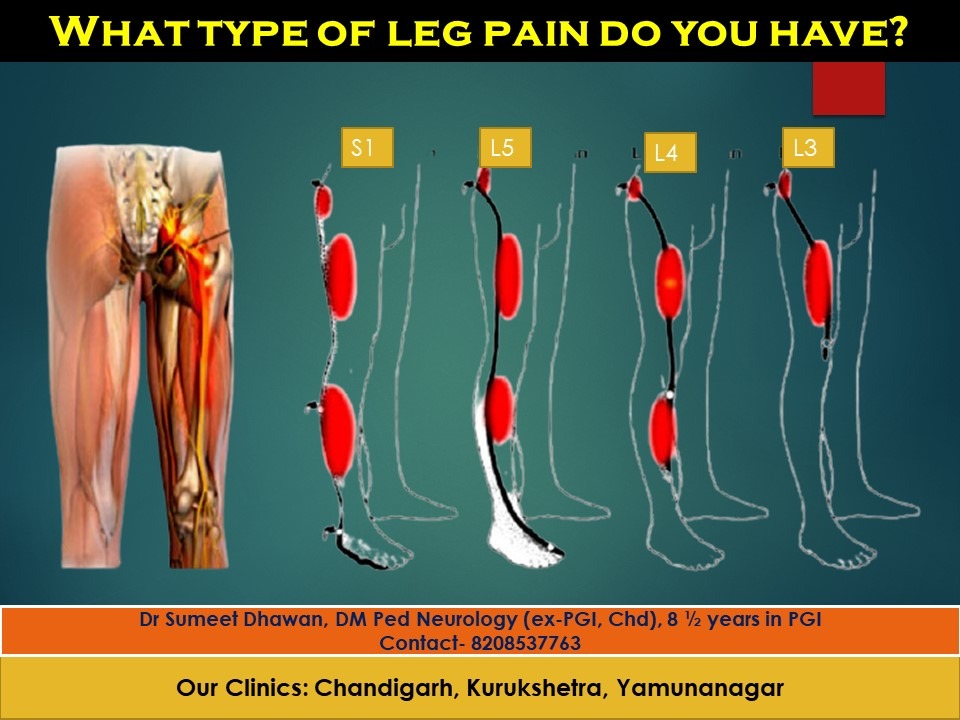 Back pain and leg pain- You may have a spine problem