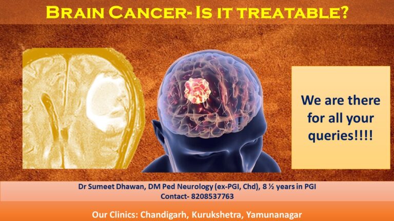 brain-cancer-surgery-and-treatment-every-day-is-important-dr-sumeet