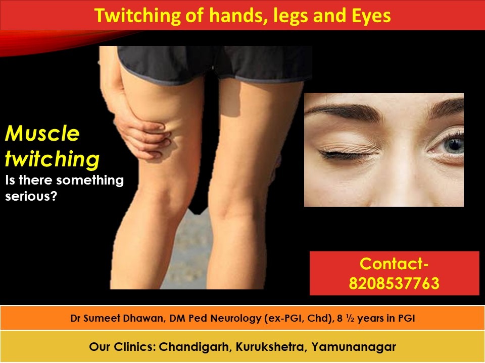 muscle-twitching-treatment-and-causes-dr-sumeet-dhawan-neurologist