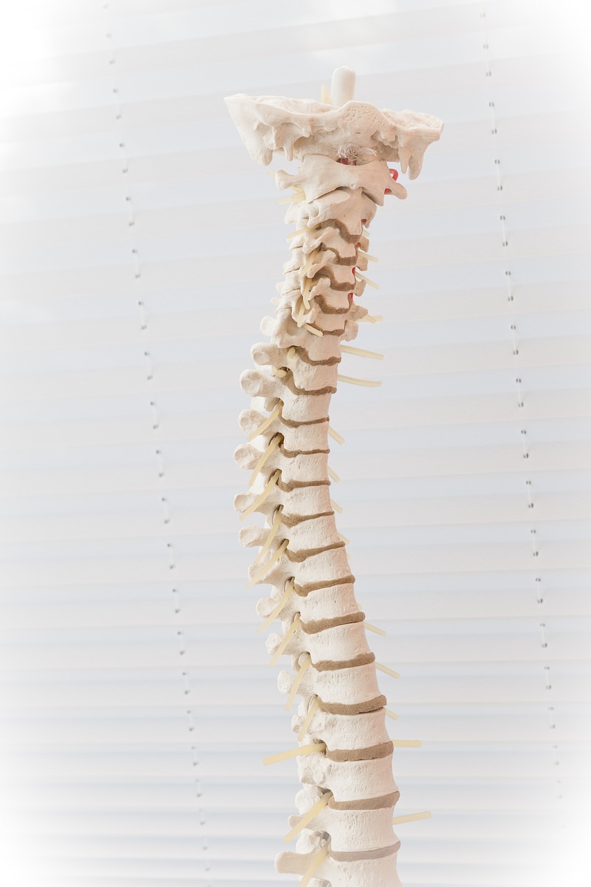 back pain sciatica causes